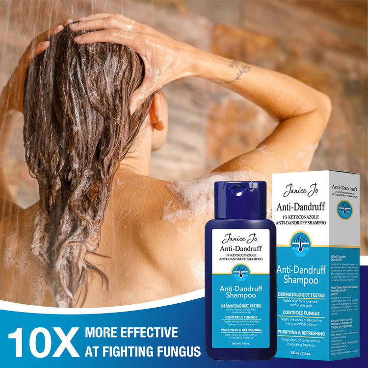 1% Ketoconazole Anti-Dandruff Oil Control Shampoo